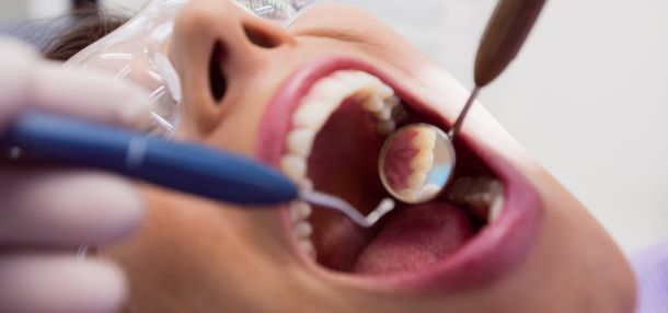 Sanguinamento delle gengive: le principali cause (e il rimedio che non sempre piace)