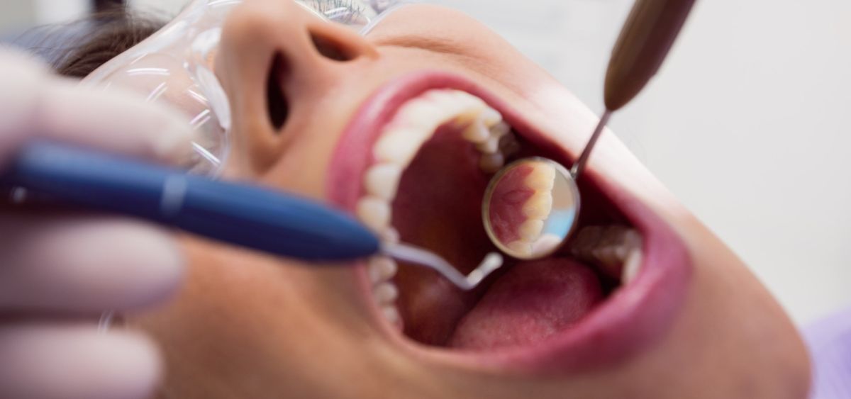 Sanguinamento delle gengive: le principali cause (e il rimedio che non sempre piace)